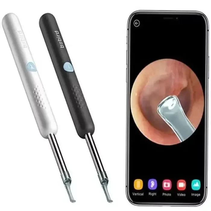 گوش پاک کن هوشمند شیائومی Bebird R1