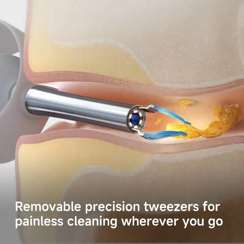 گوش پاک کن شیائومی